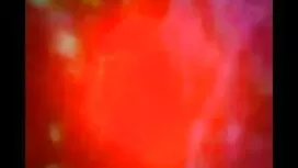 সামার হার্ড & লন্ডন  ...